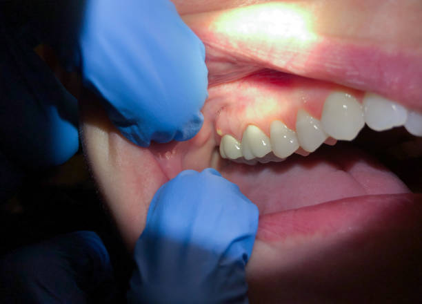  Lakewood Clu, MI Emergency Dentist Pros