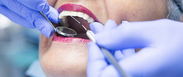 Best Emergency Care for Gum Disease in Lakewood Clu, MI